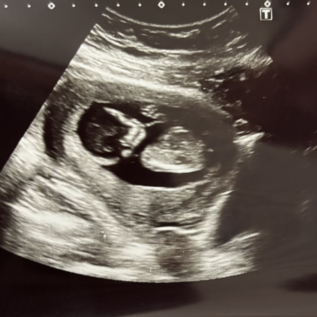 Photo shared by Mckenzie for their Babylist baby registry.