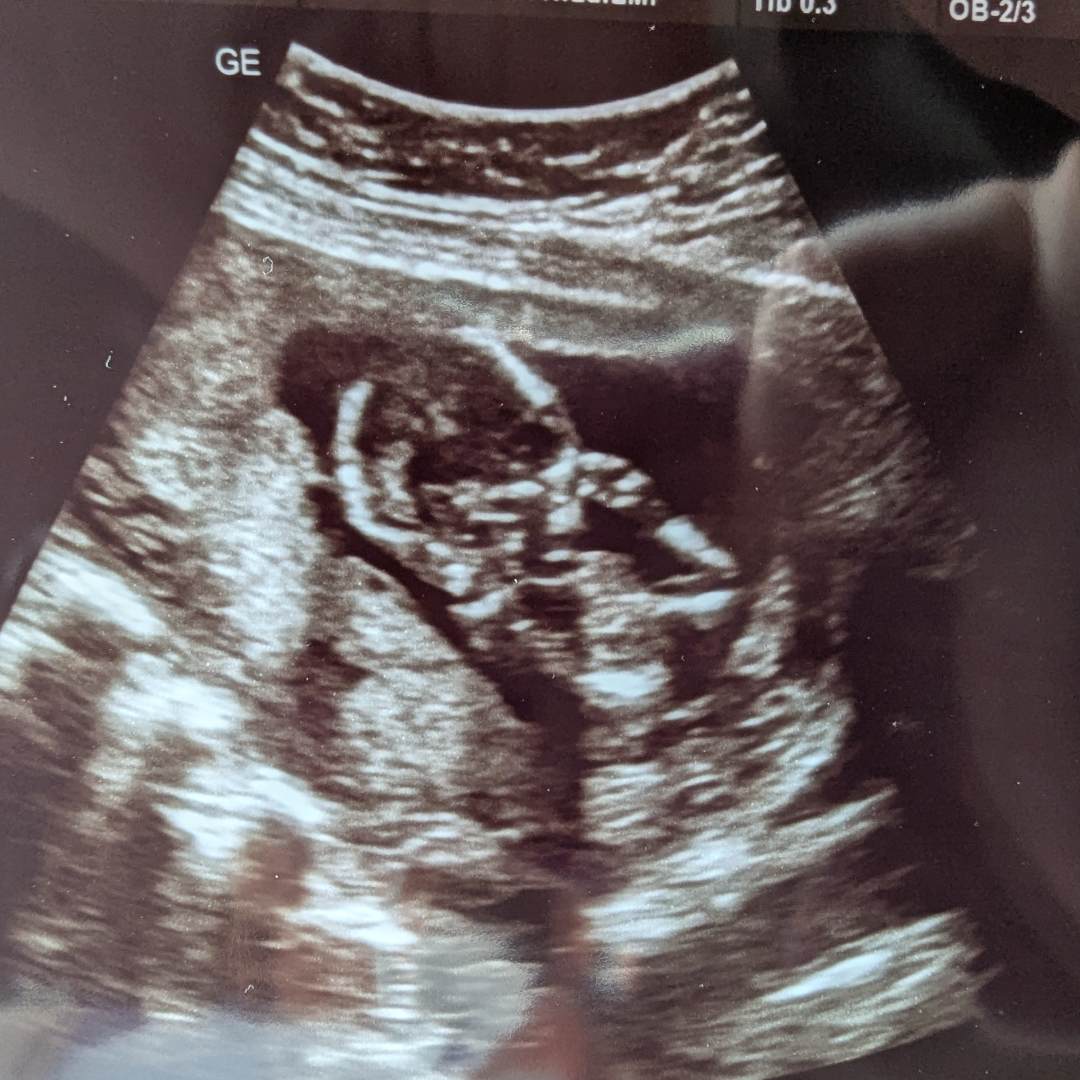 Photo shared by Holly for their Babylist baby registry.