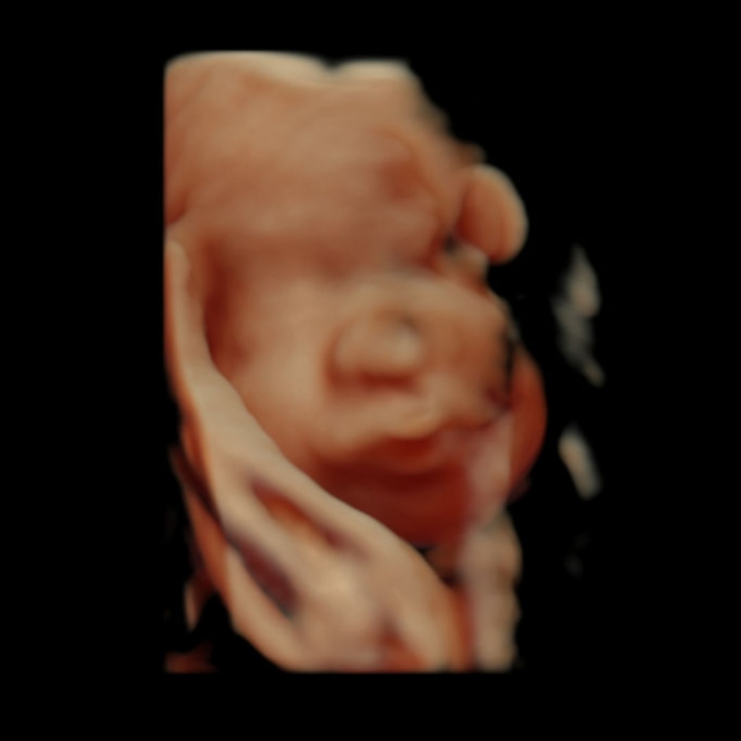 Photo shared by Jaidyn for their Babylist baby registry.