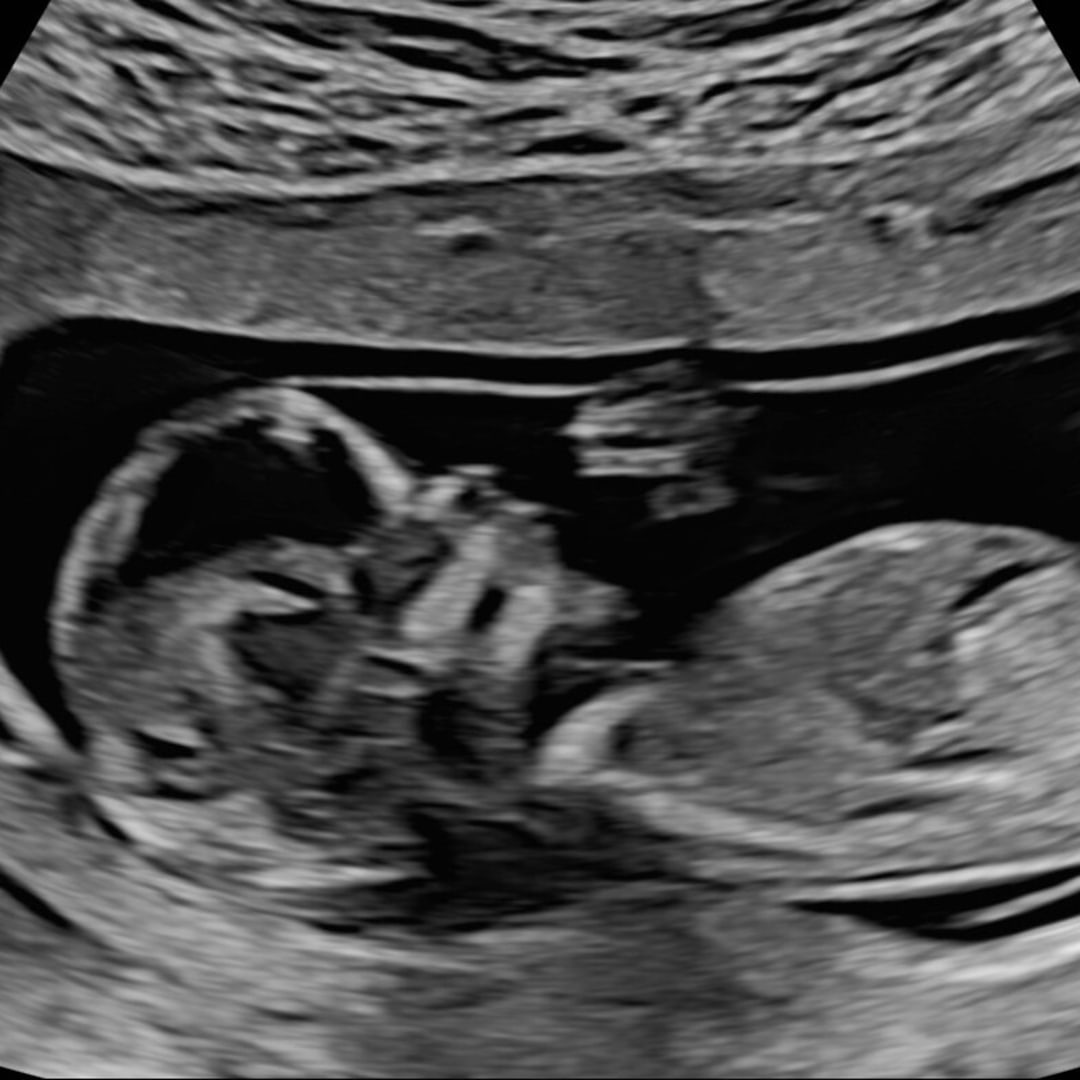 Photo shared by Mark for their Babylist baby registry.