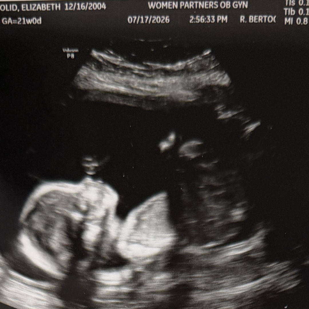 Photo shared by Elizabeth for their Babylist baby registry.