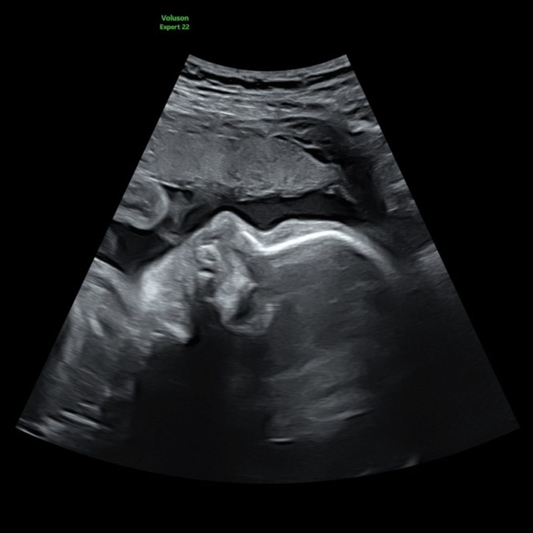 Photo shared by Amethyst for their Babylist baby registry.