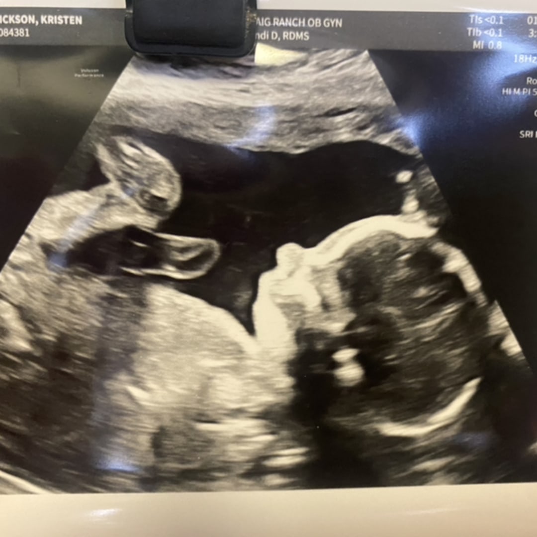 Photo shared by Kristen for their Babylist baby registry.