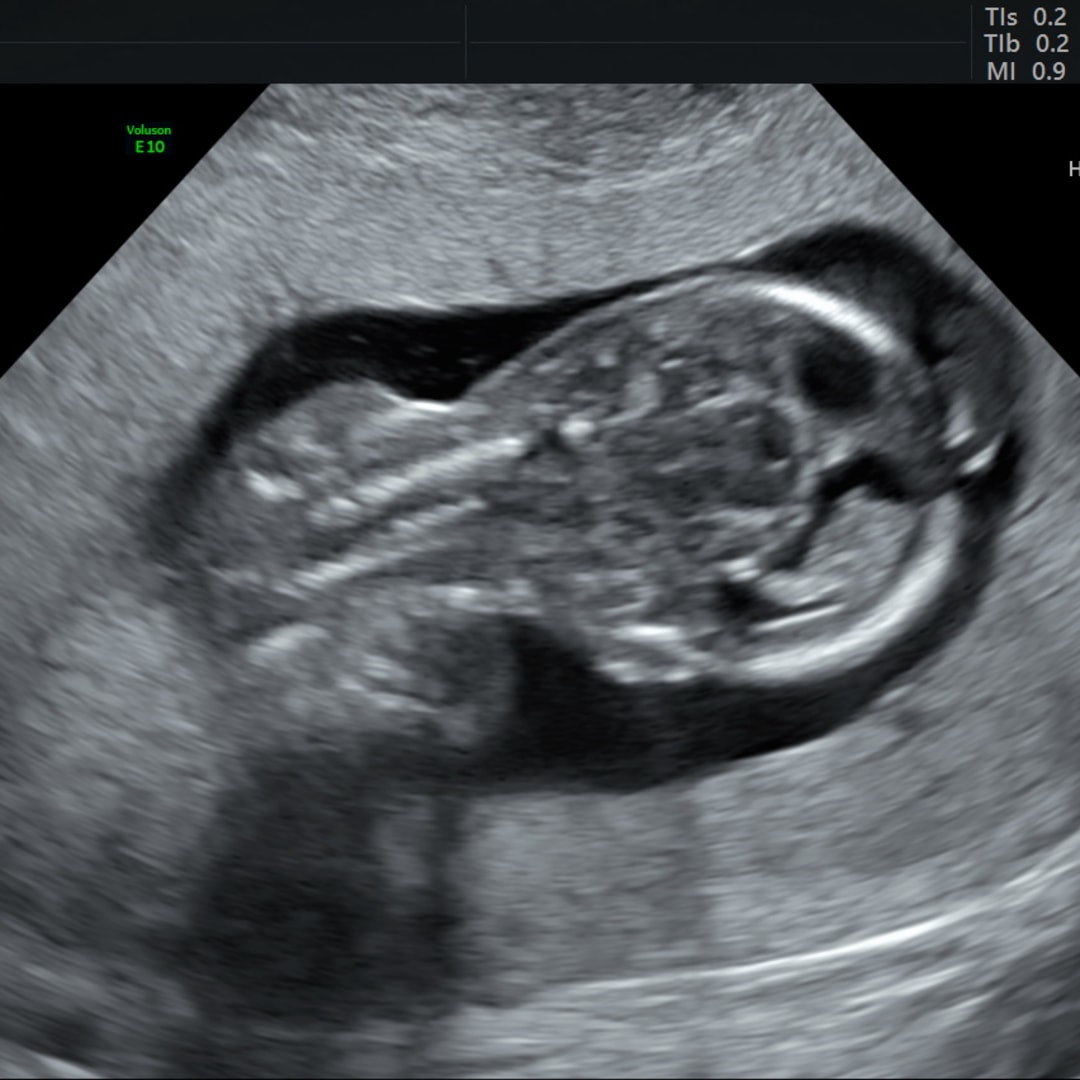 Photo shared by Sheena for their Babylist baby registry.