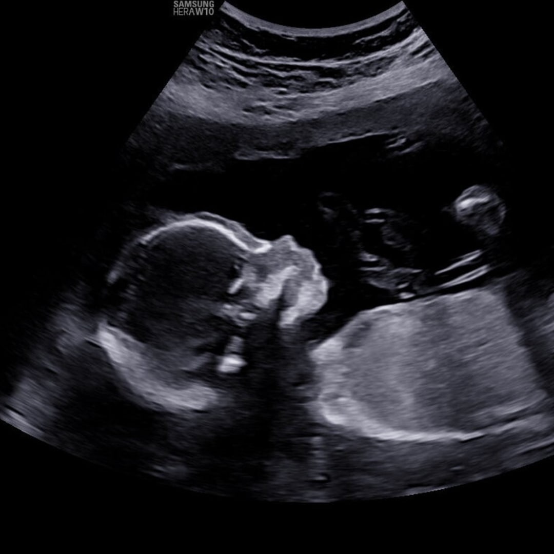Photo shared by Brenna for their Babylist baby registry.