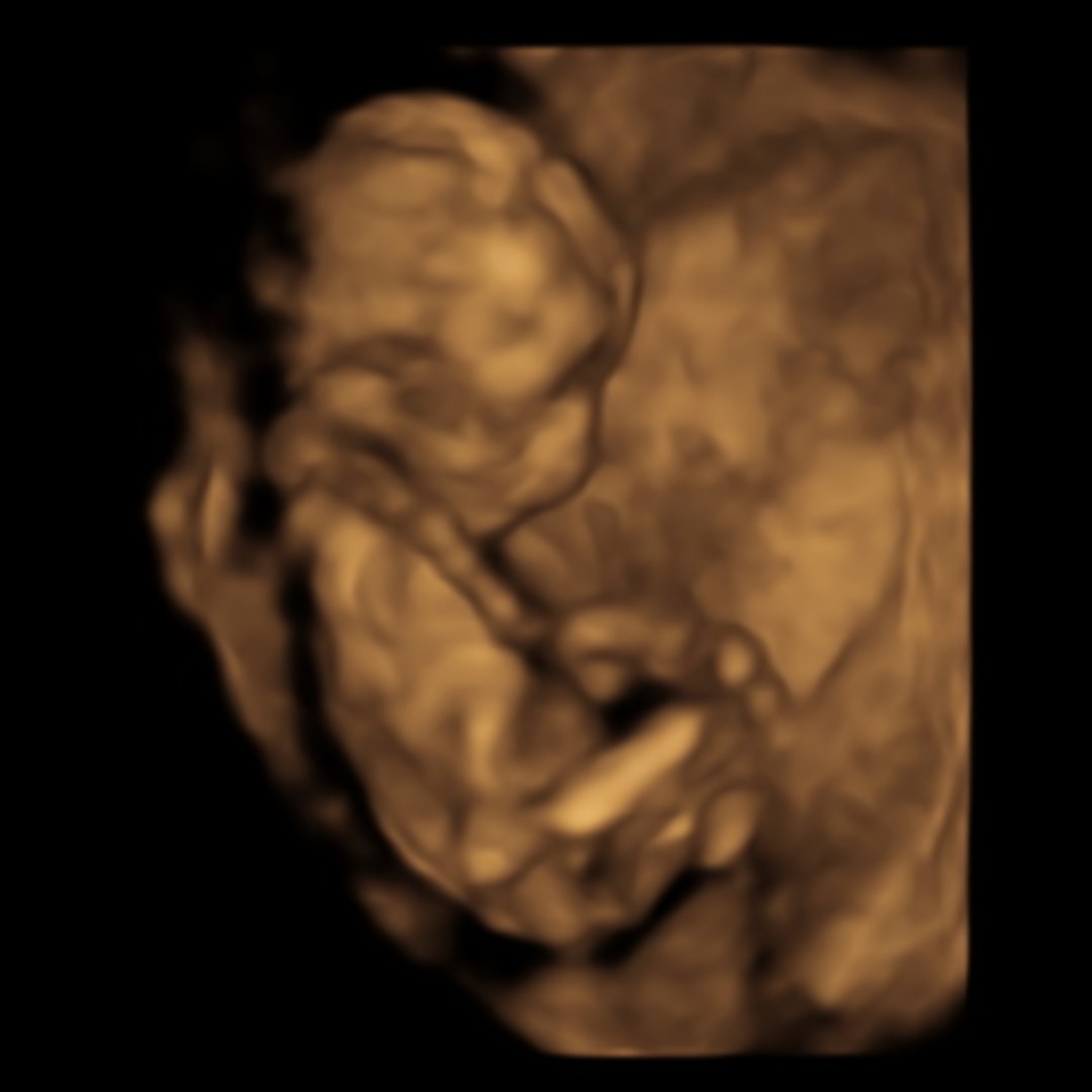 Photo shared by Emily for their Babylist baby registry.