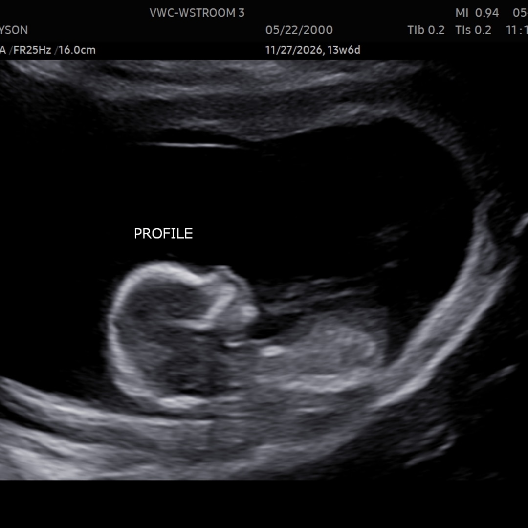 Photo shared by Alan for their Babylist baby registry.
