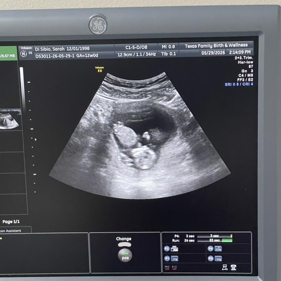 Photo shared by Sarah for their Babylist baby registry.