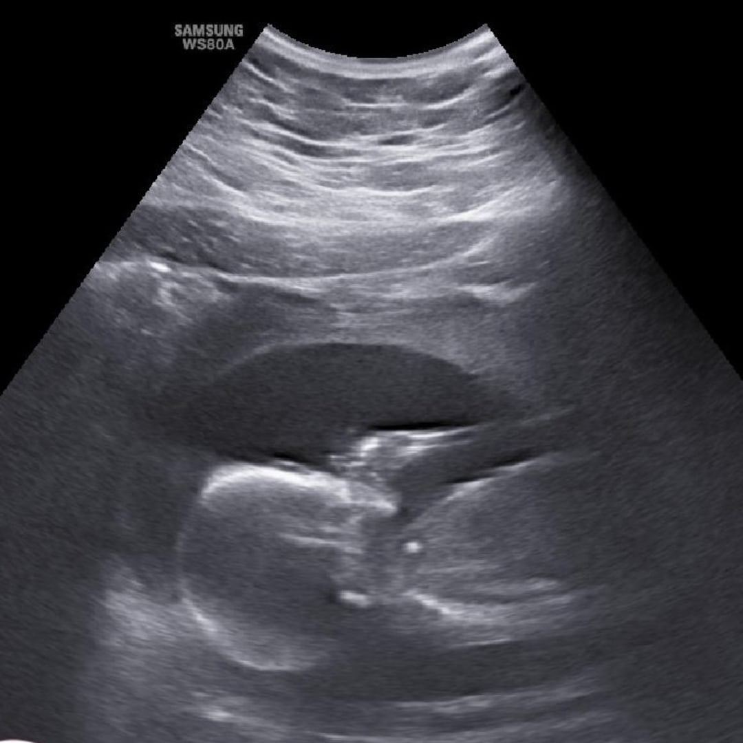 Photo shared by Chelsie for their Babylist baby registry.