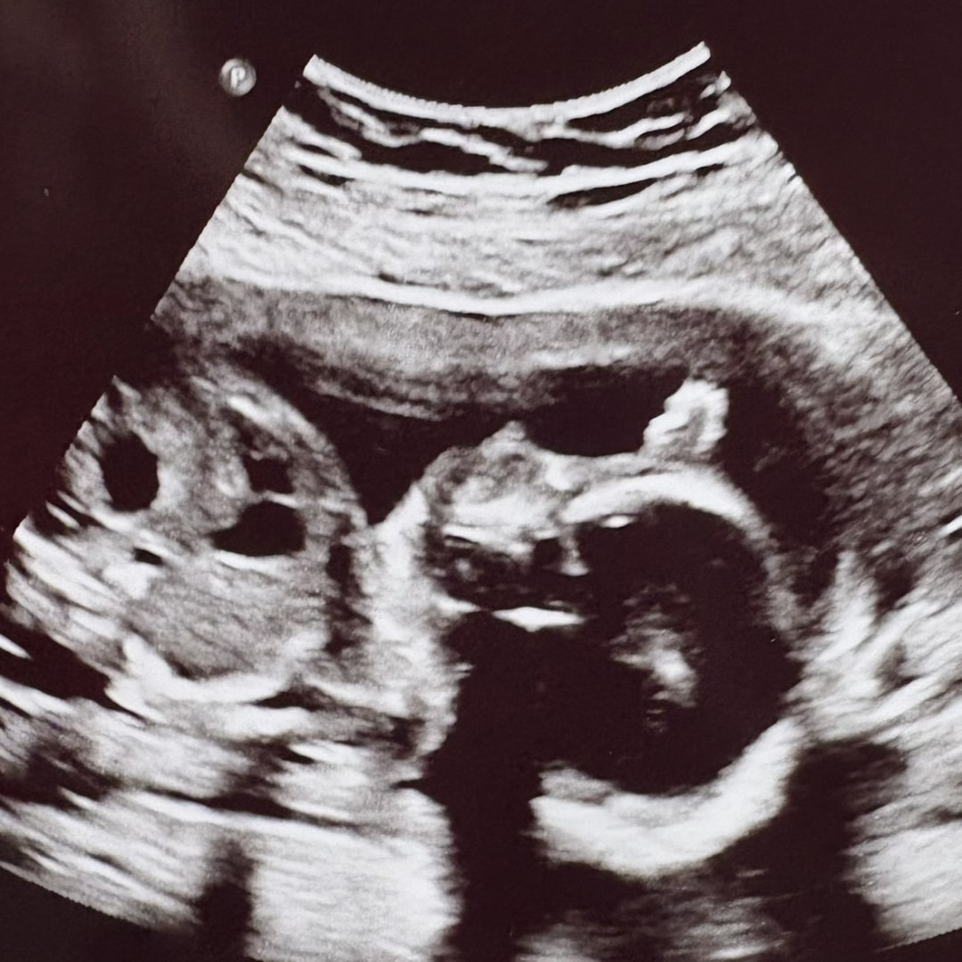 Photo shared by Stephanie for their Babylist baby registry.