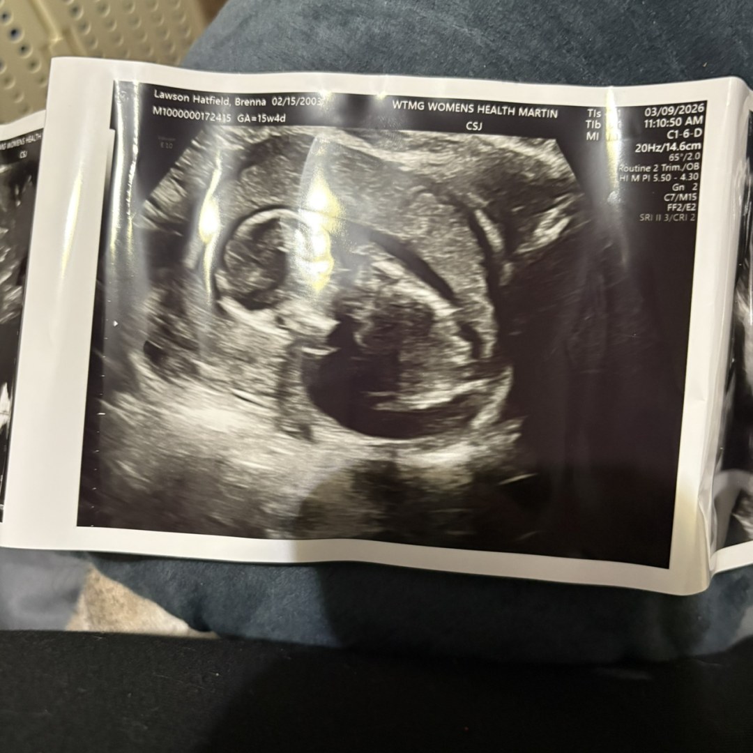 Photo shared by Brenna for their Babylist baby registry.