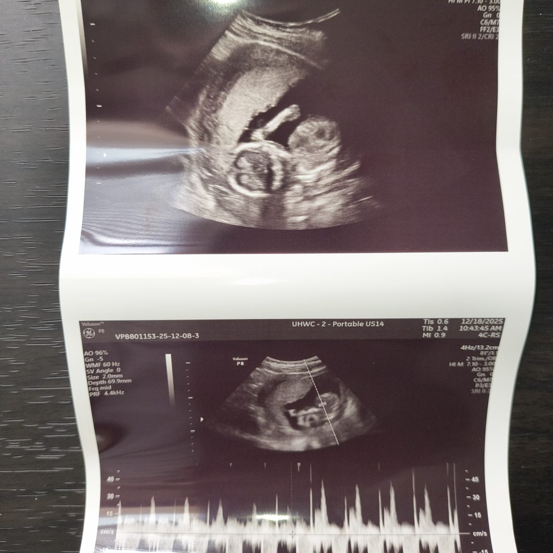 Photo shared by Ikierra for their Babylist baby registry.