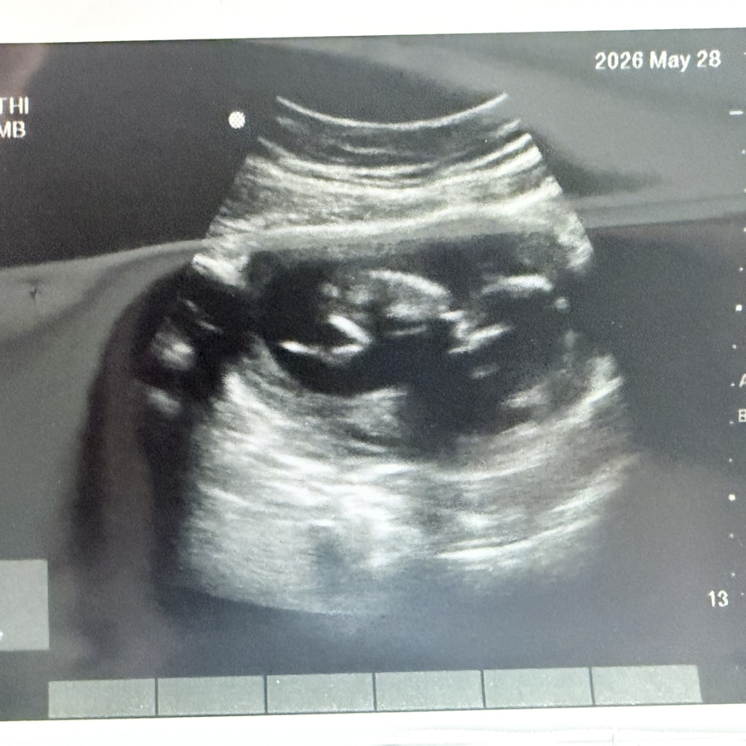 Photo shared by Tori for their Babylist baby registry.