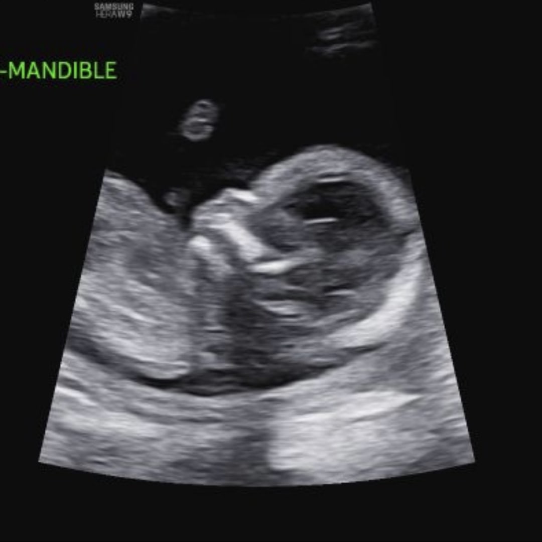 Photo shared by Rebecca for their Babylist baby registry.