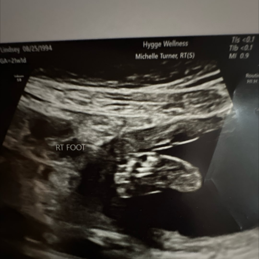Photo shared by Lindsey for their Babylist baby registry.