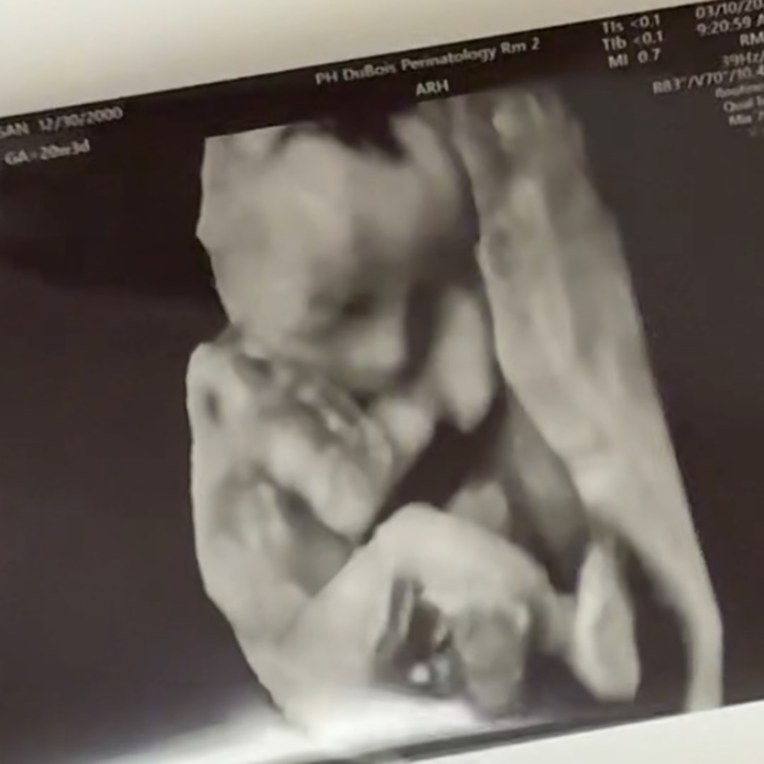 Photo shared by Morgan for their Babylist baby registry.