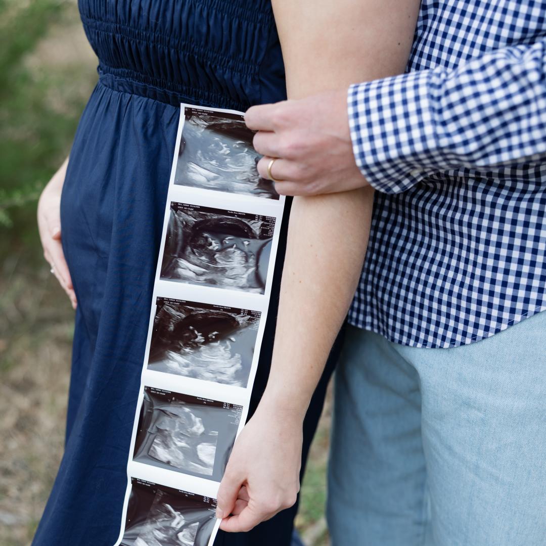 Photo shared by Sarah for their Babylist baby registry.