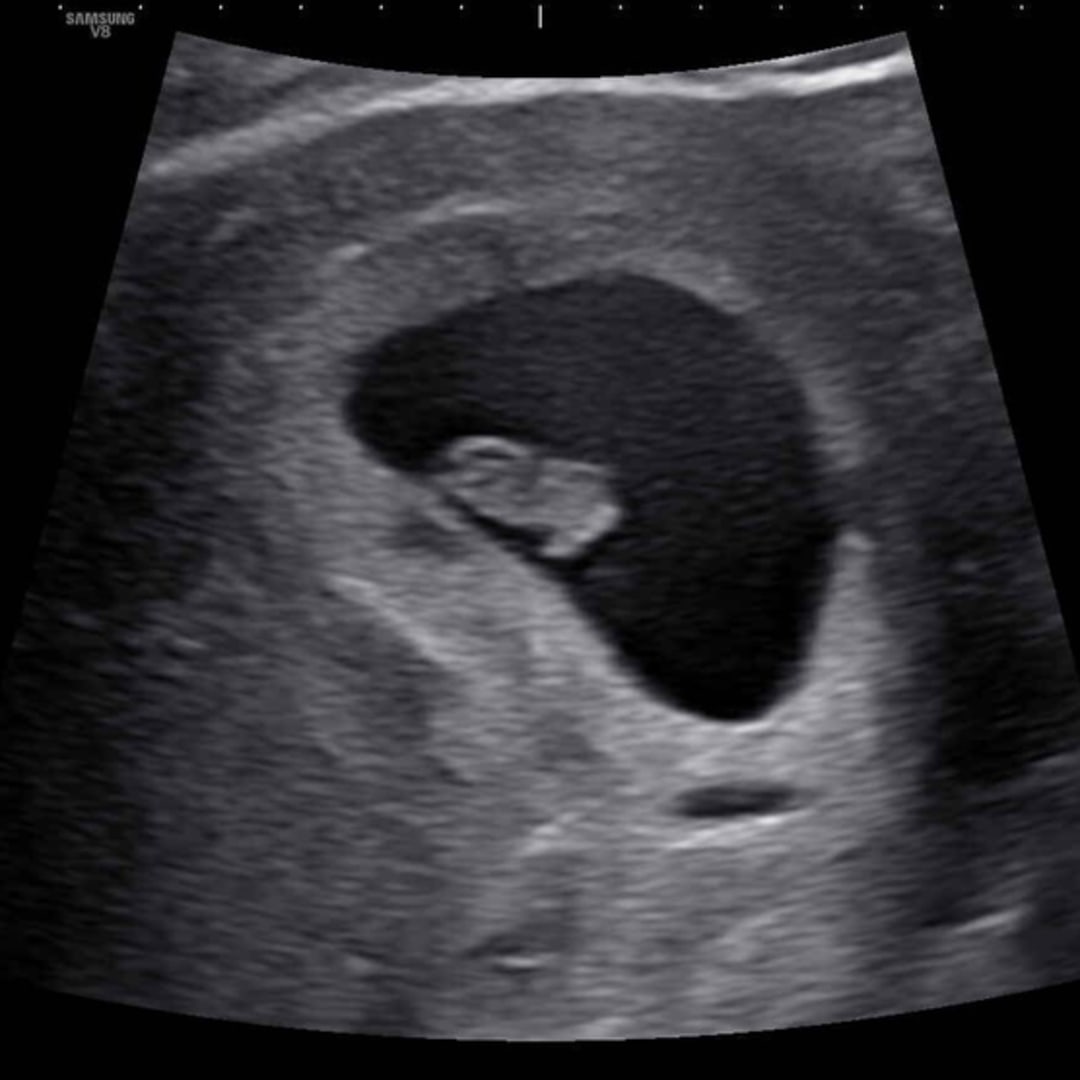 Photo shared by Kat for their Babylist baby registry.