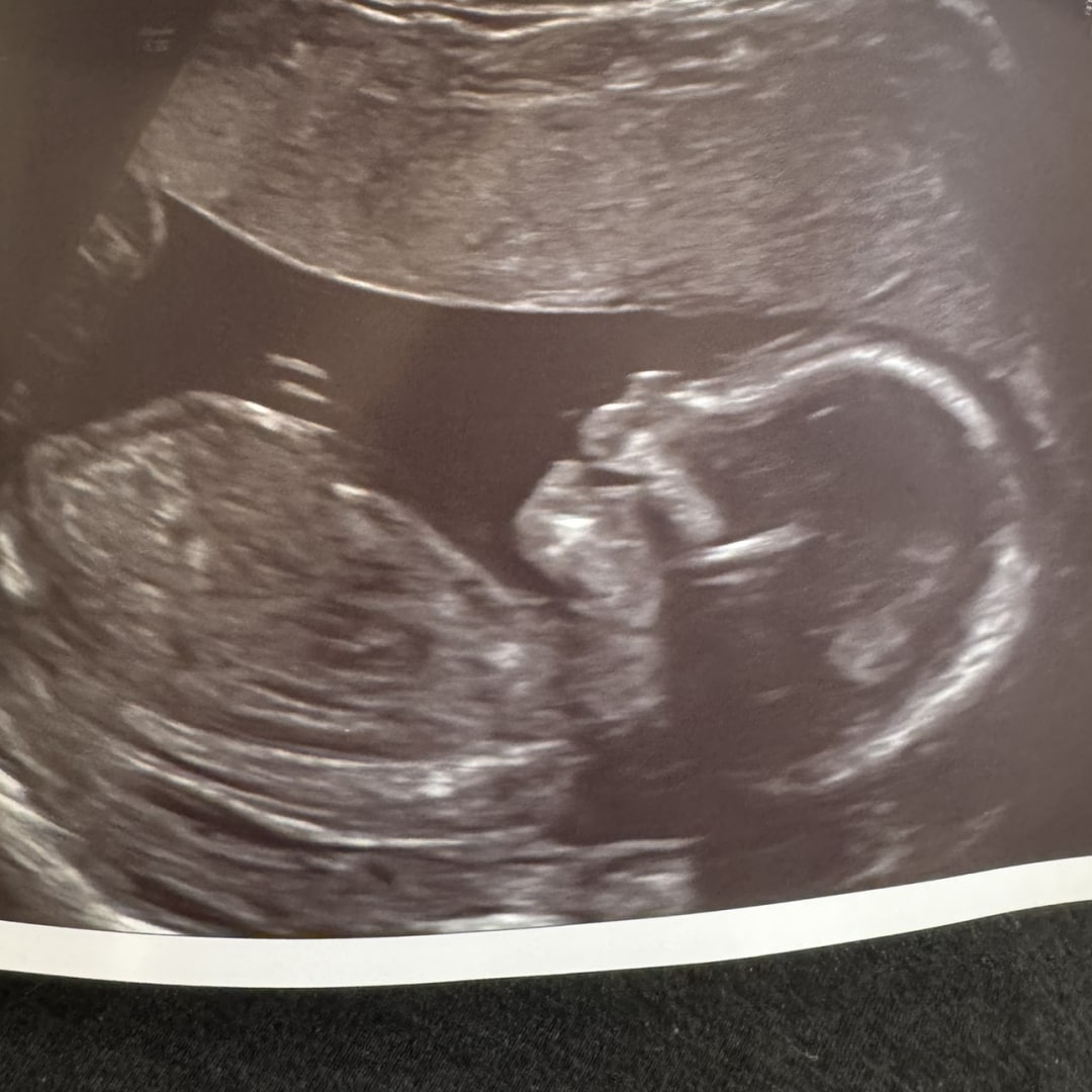 Photo shared by Nikki for their Babylist baby registry.
