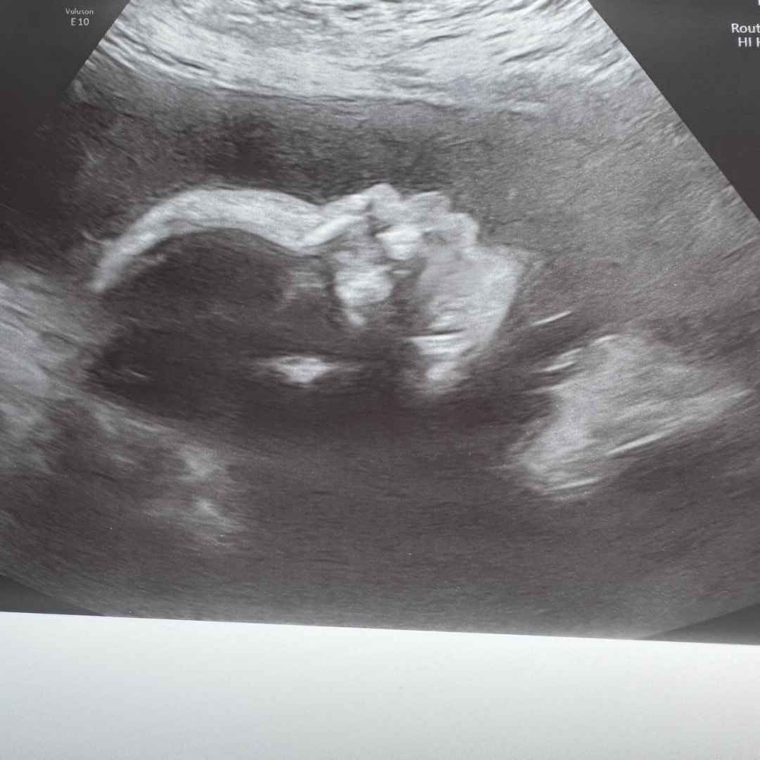 Photo shared by Iyaly for their Babylist baby registry.