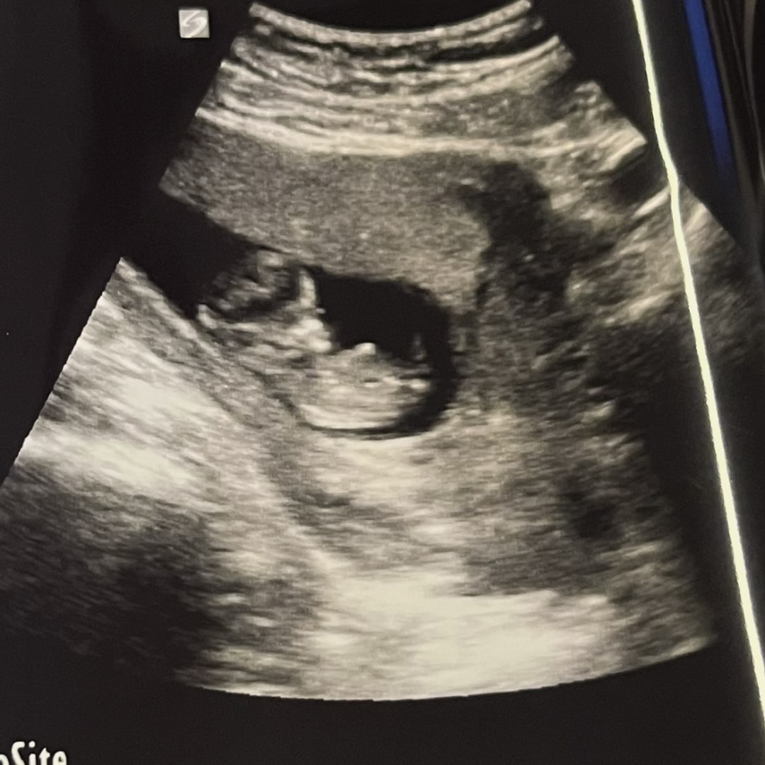 Photo shared by Zaira for their Babylist baby registry.