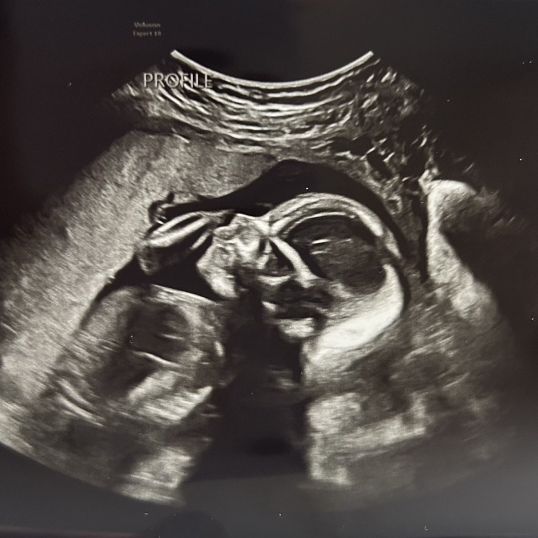 Photo shared by Ashleigh for their Babylist baby registry.