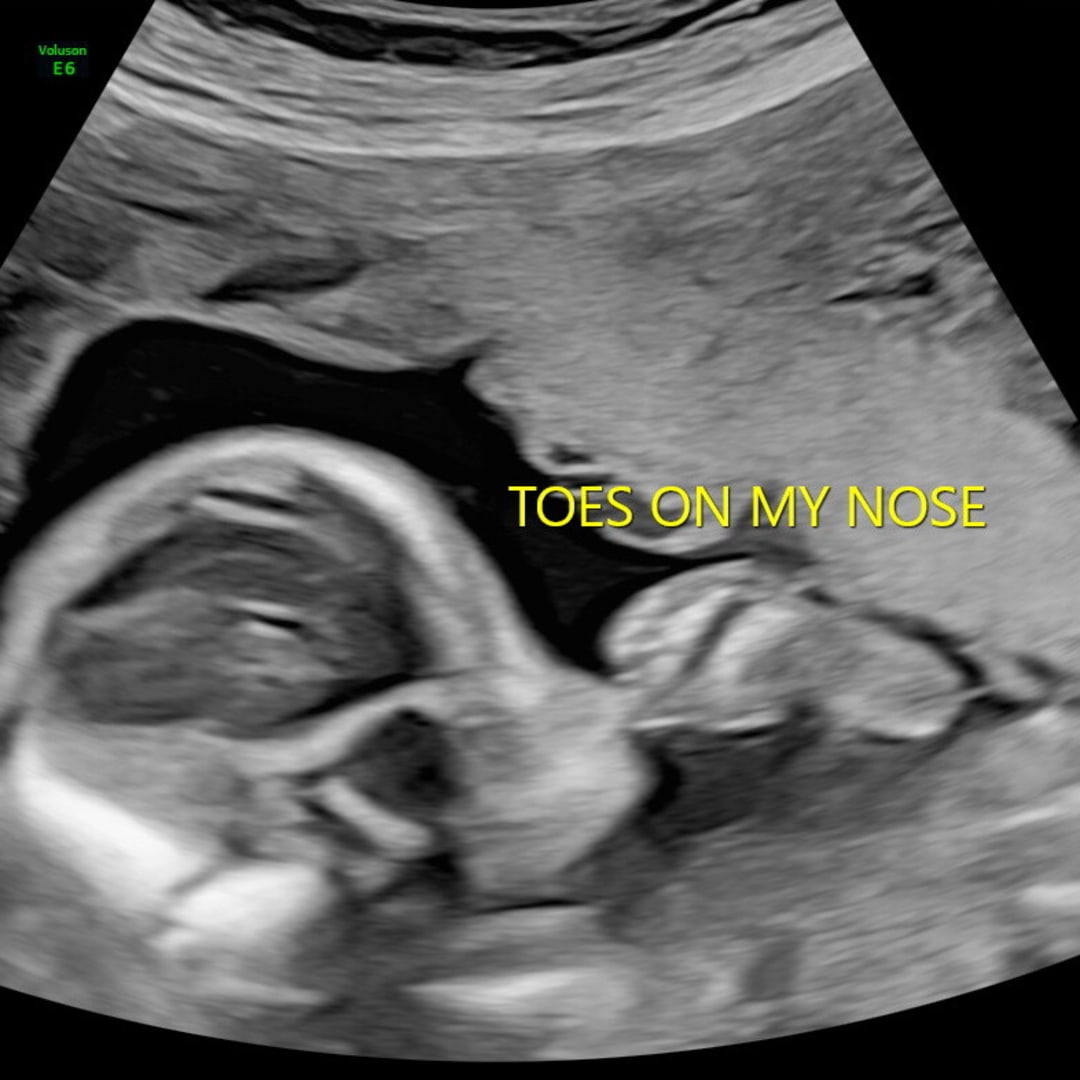 Photo shared by Jilian for their Babylist baby registry.