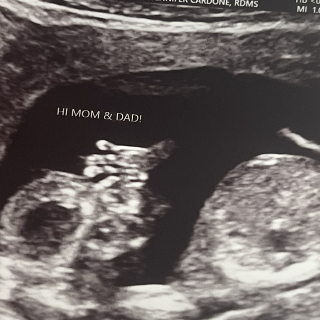 Photo shared by Issany for their Babylist baby registry.
