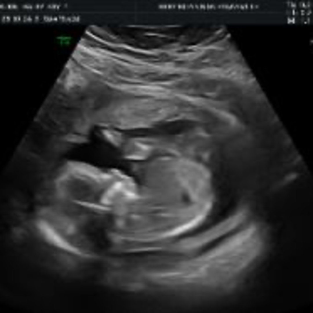 Photo shared by Haley-Kay for their Babylist baby registry.