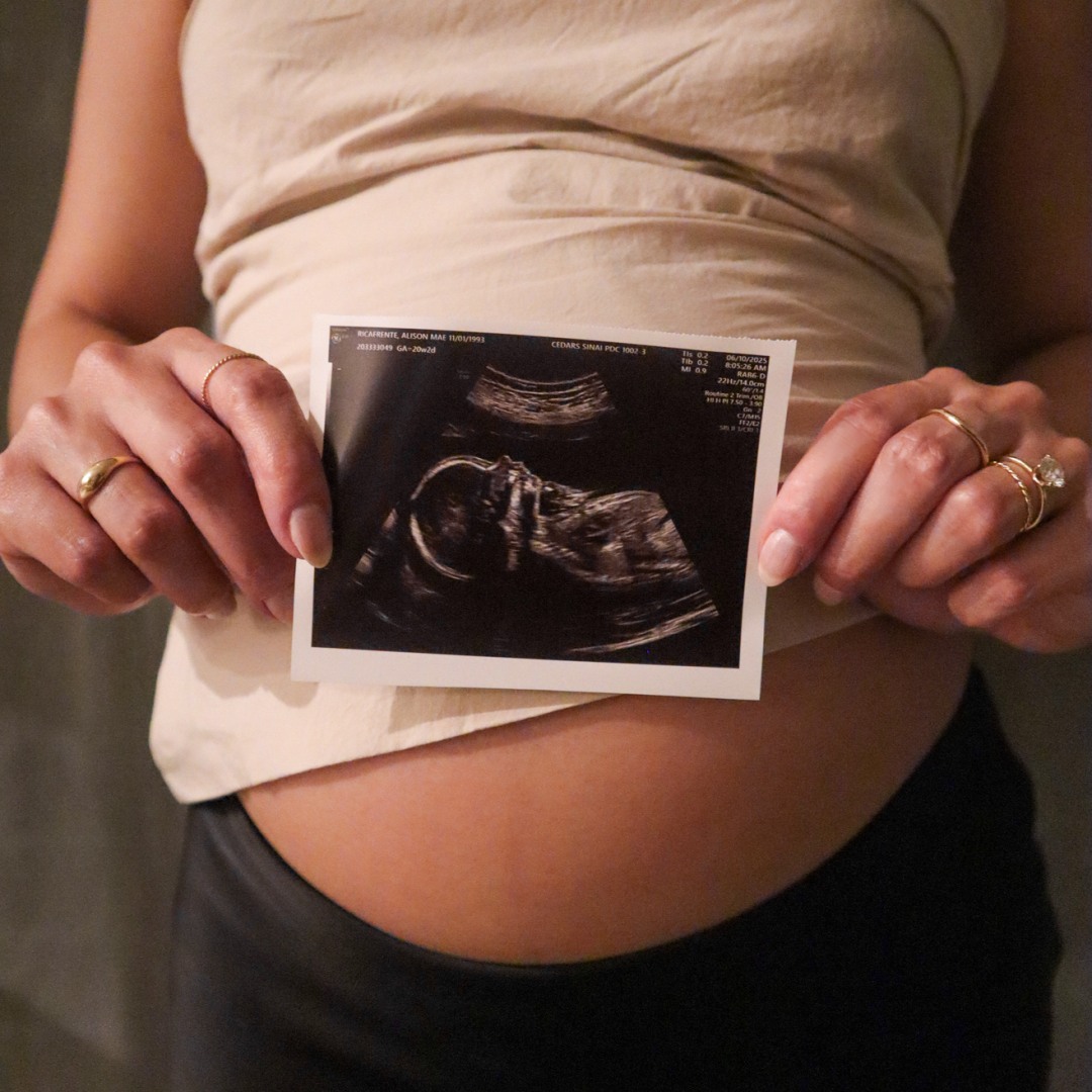 Photo shared by Alison for their Babylist baby registry.