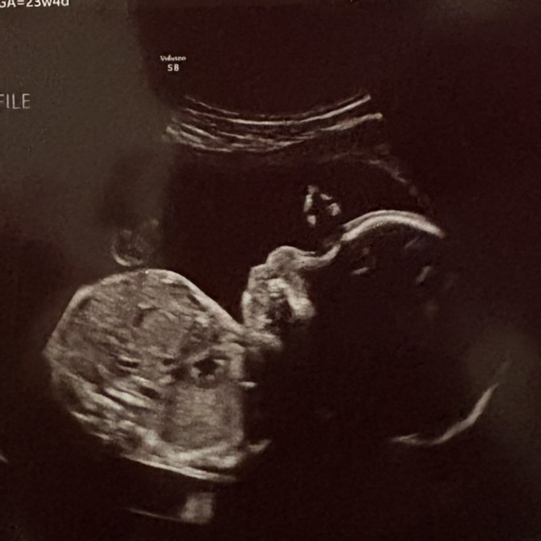 Photo shared by Latoya for their Babylist baby registry.