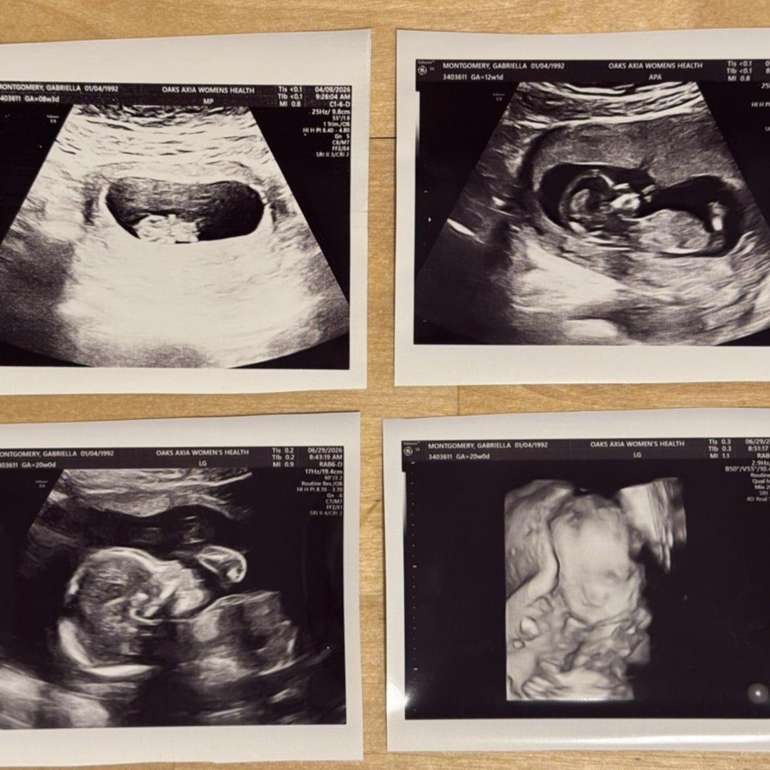 Photo shared by Gabriella for their Babylist baby registry.