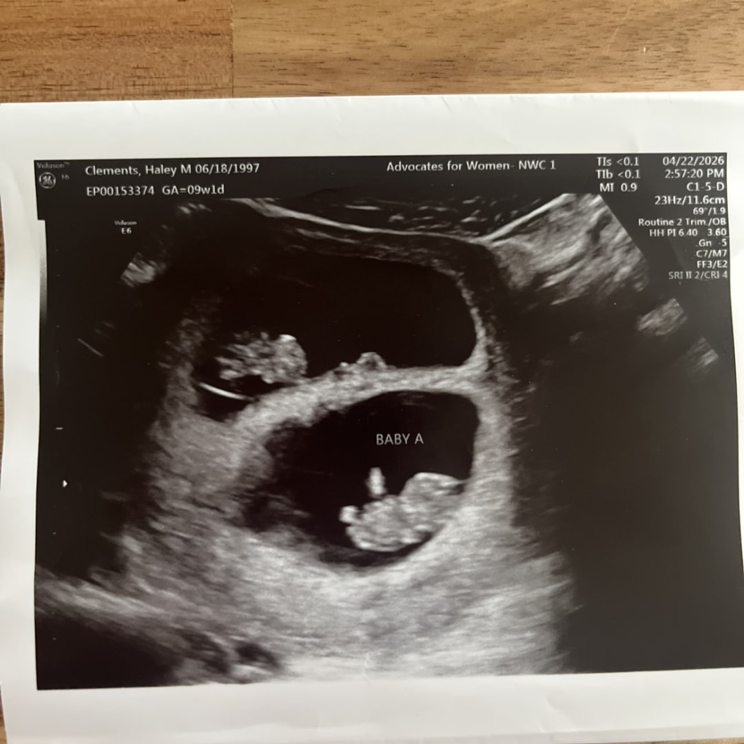 Photo shared by Haley for their Babylist baby registry.
