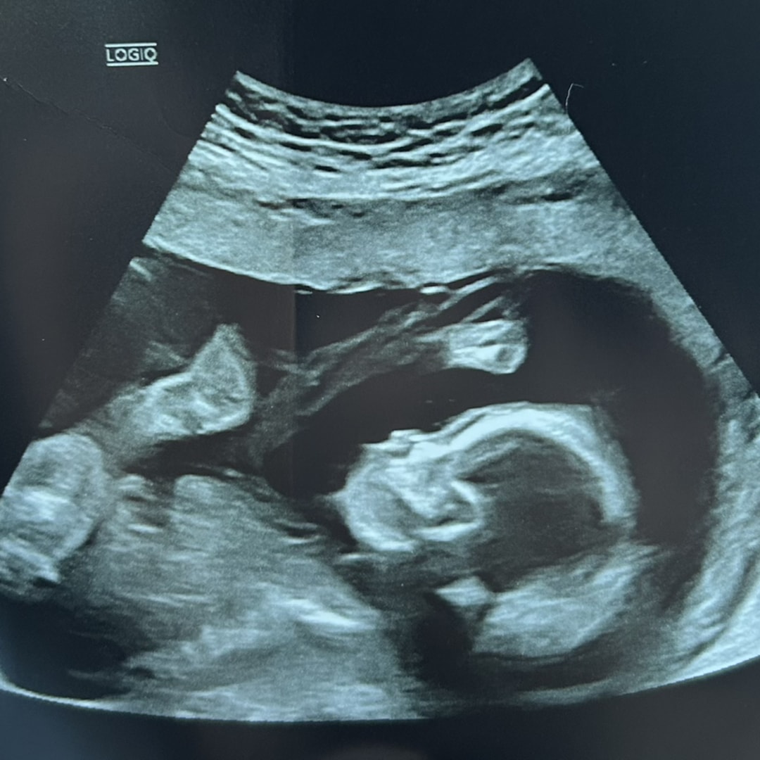 Photo shared by Abby for their Babylist baby registry.