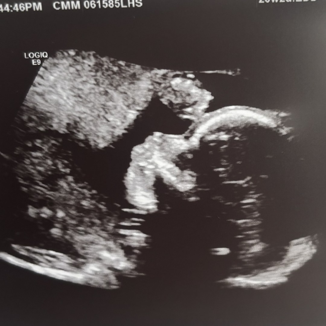 Photo shared by Faith for their Babylist baby registry.