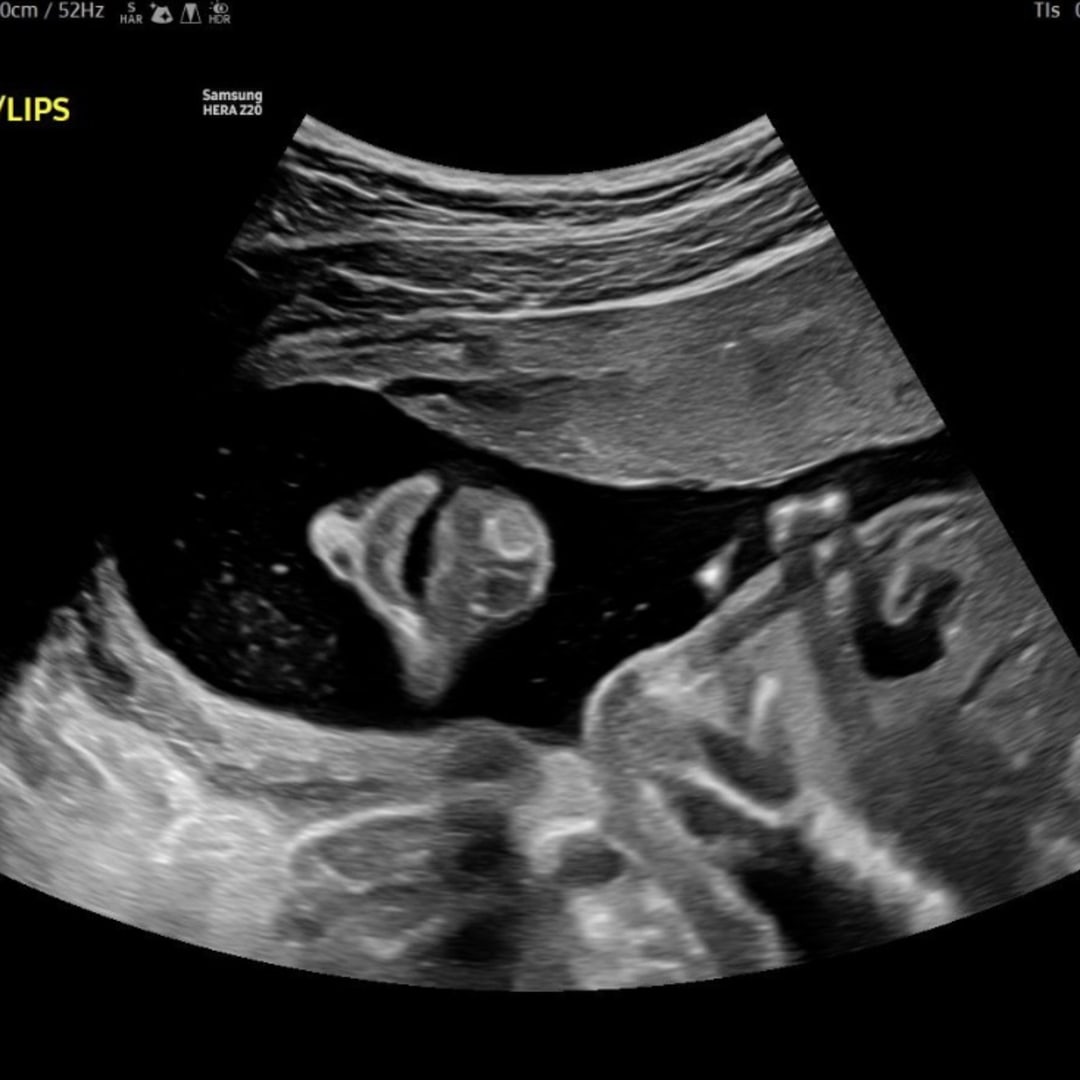 Photo shared by Taylor for their Babylist baby registry.