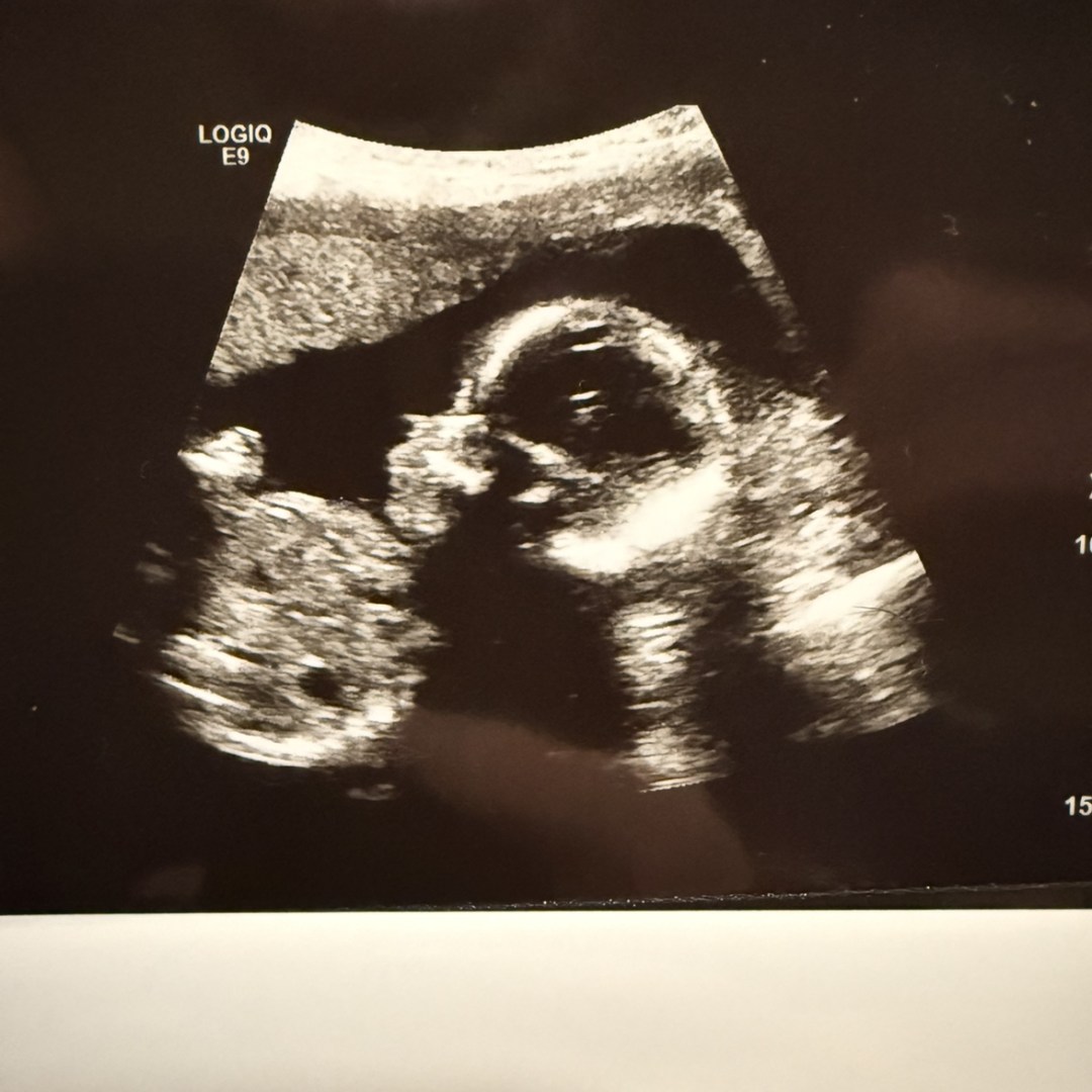 Photo shared by Maddie for their Babylist baby registry.
