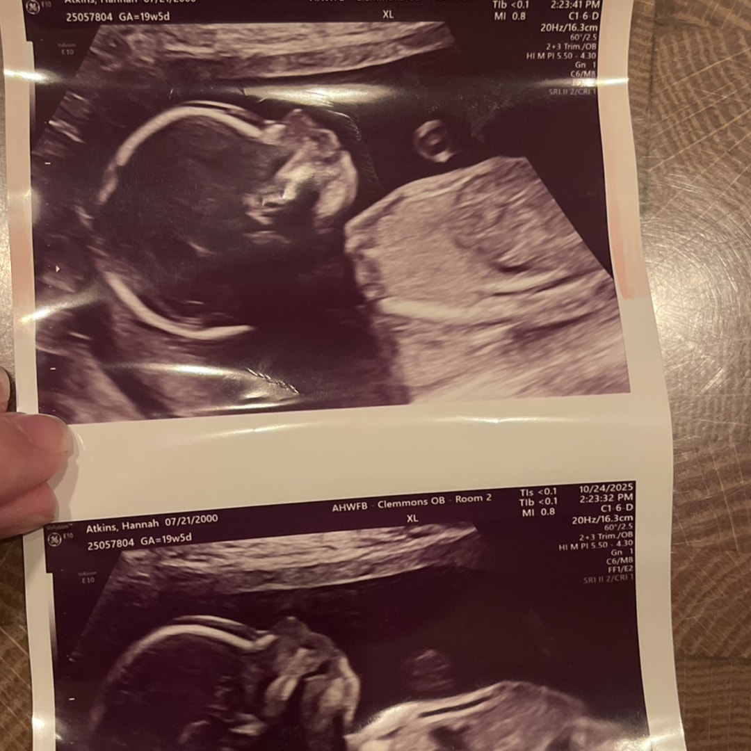 Photo shared by Hannah for their Babylist baby registry.