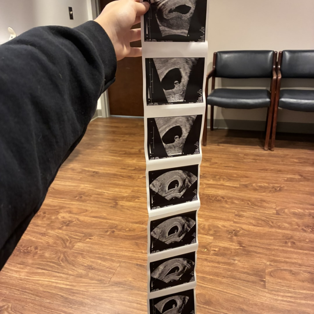 Photo shared by Kelsie for their Babylist baby registry.