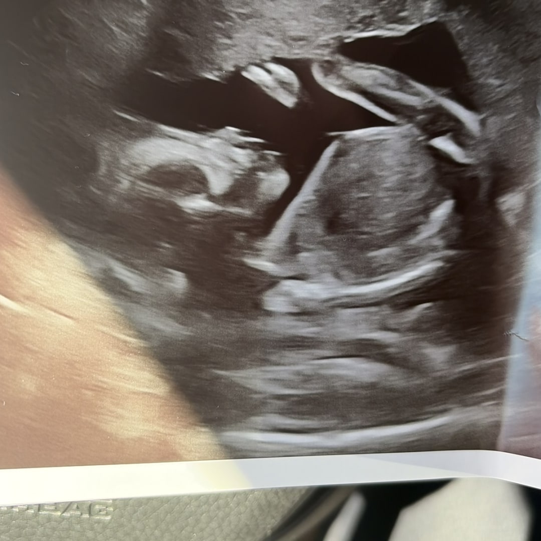 Photo shared by Aileen for their Babylist baby registry.