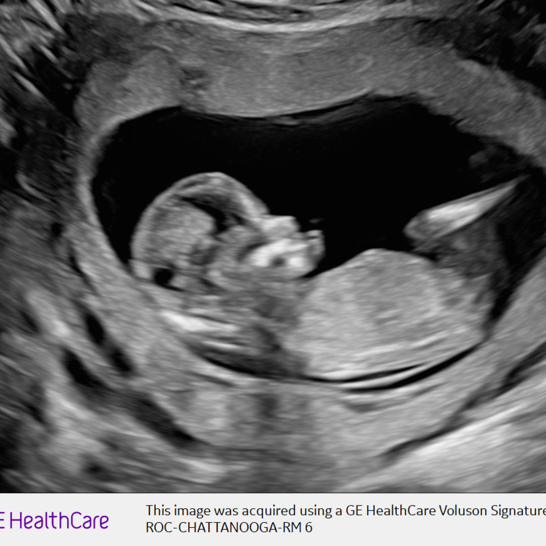 Photo shared by Taylor for their Babylist baby registry.