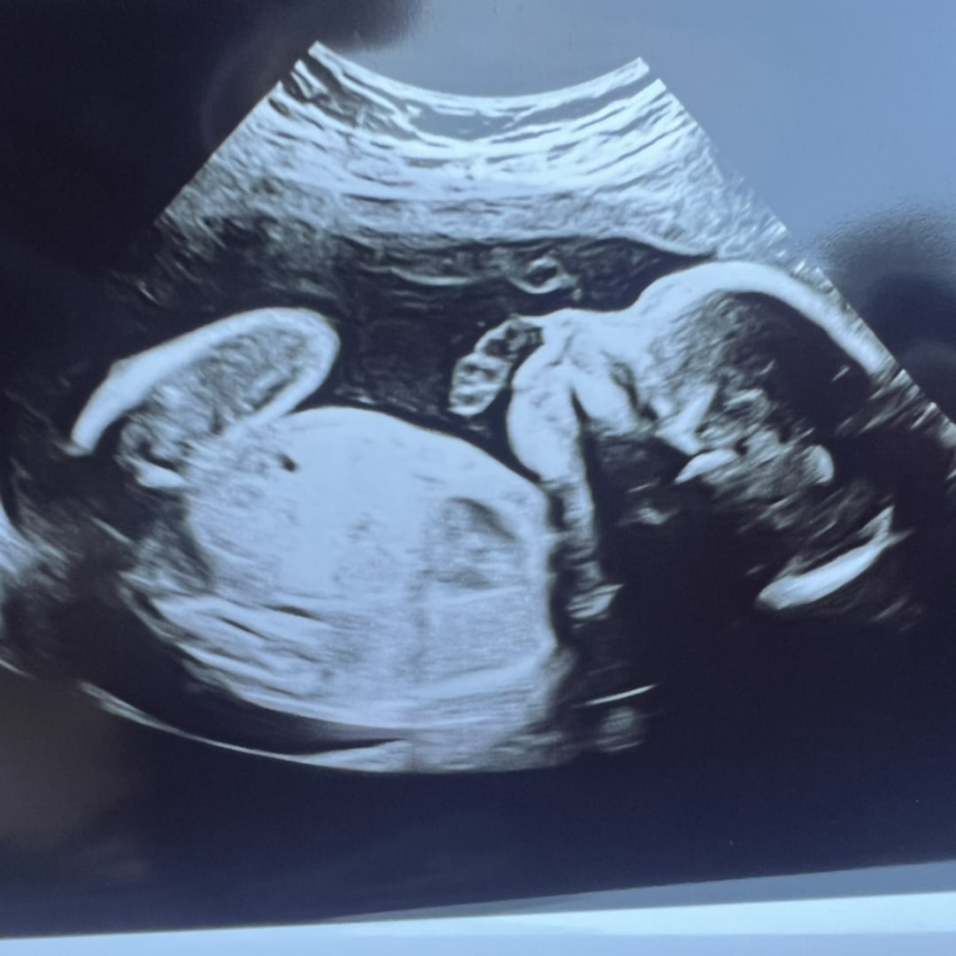 Photo shared by Carissa for their Babylist baby registry.