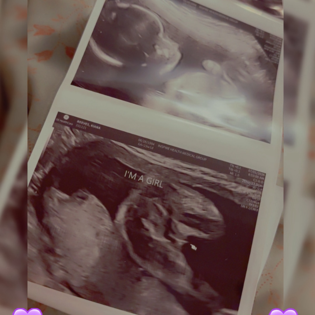 Photo shared by Kiana for their Babylist baby registry.