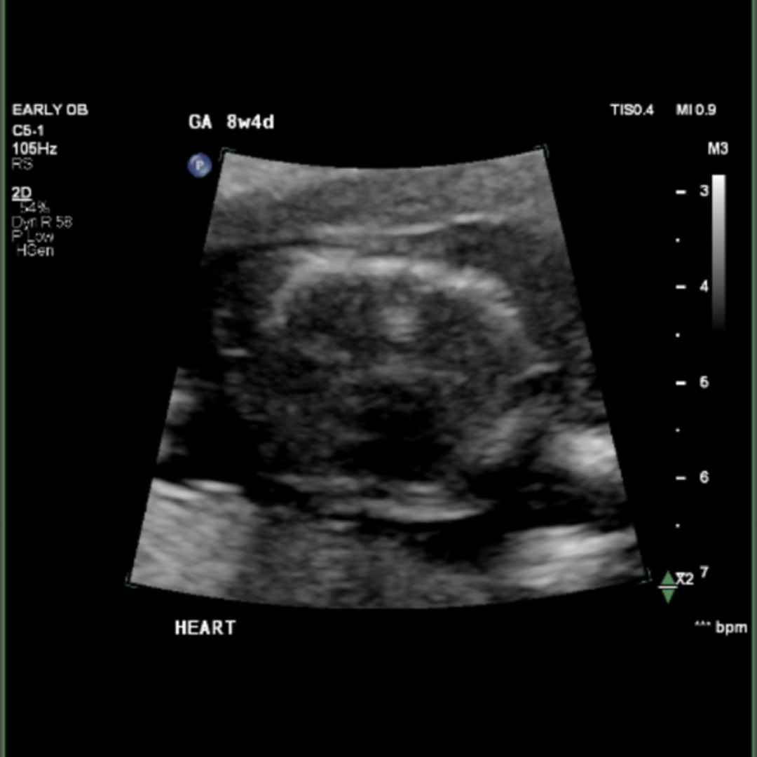 Photo shared by Jade for their Babylist baby registry.