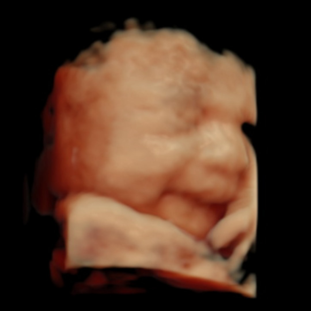 Photo shared by Michelle for their Babylist baby registry.