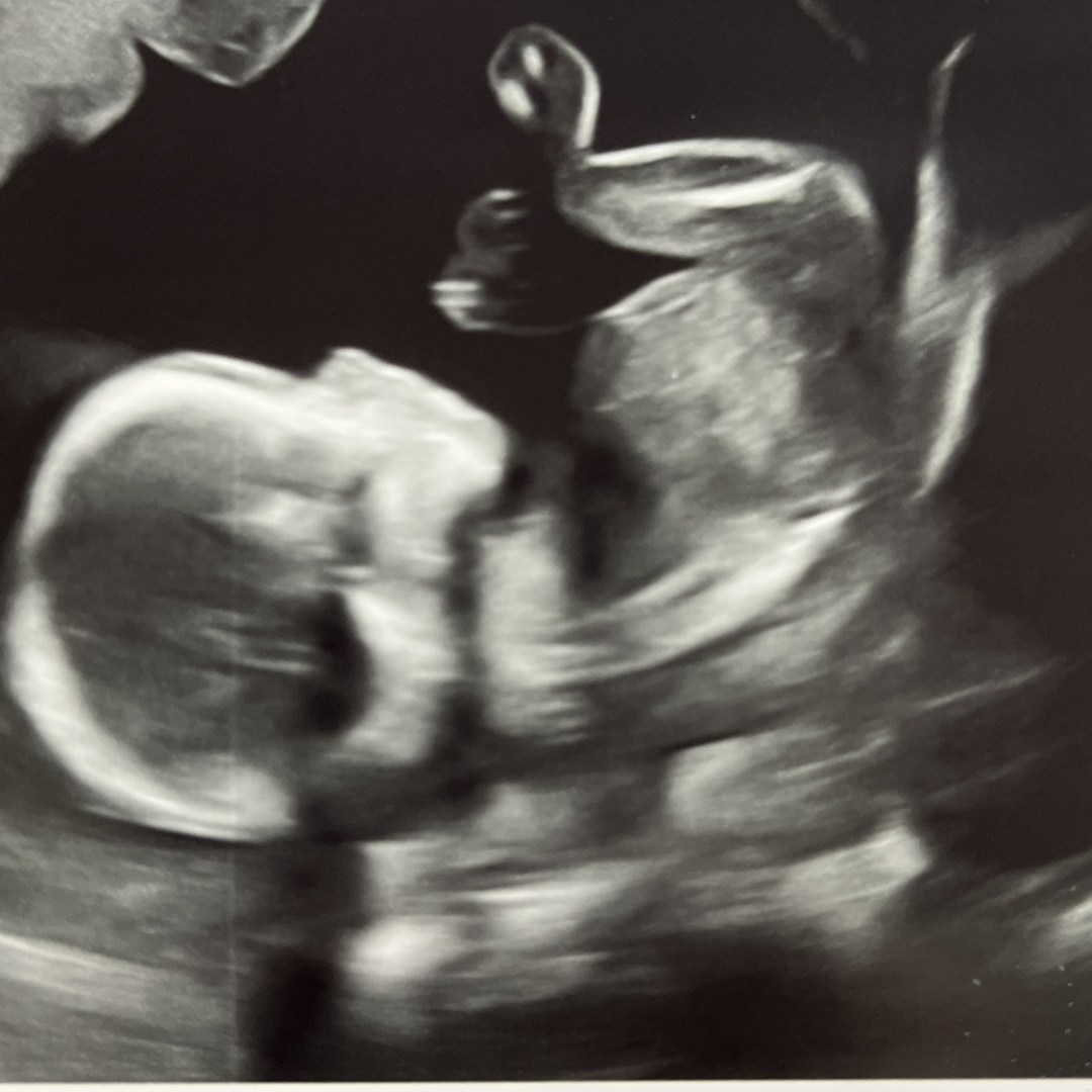 Photo shared by Ashley for their Babylist baby registry.