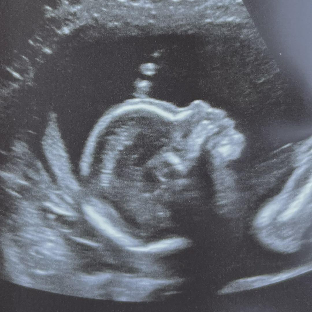 Photo shared by Denyel for their Babylist baby registry.