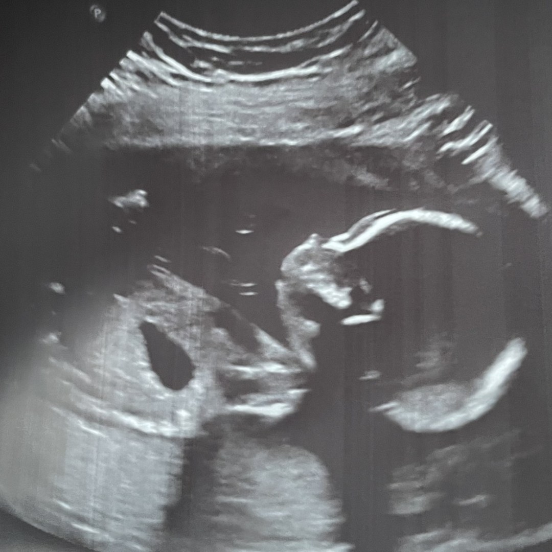 Photo shared by Alexia for their Babylist baby registry.