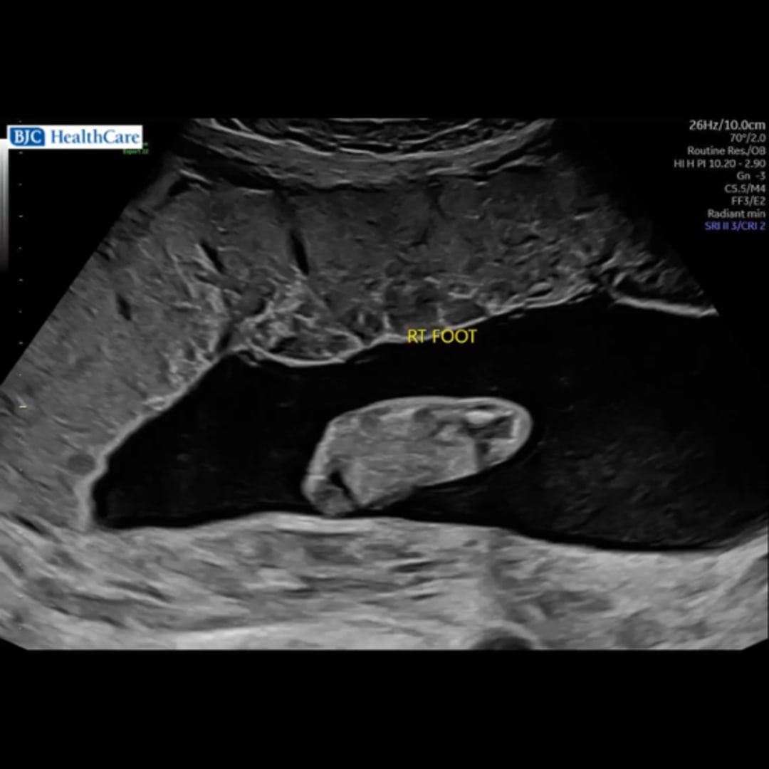 Photo shared by Leigha for their Babylist baby registry.