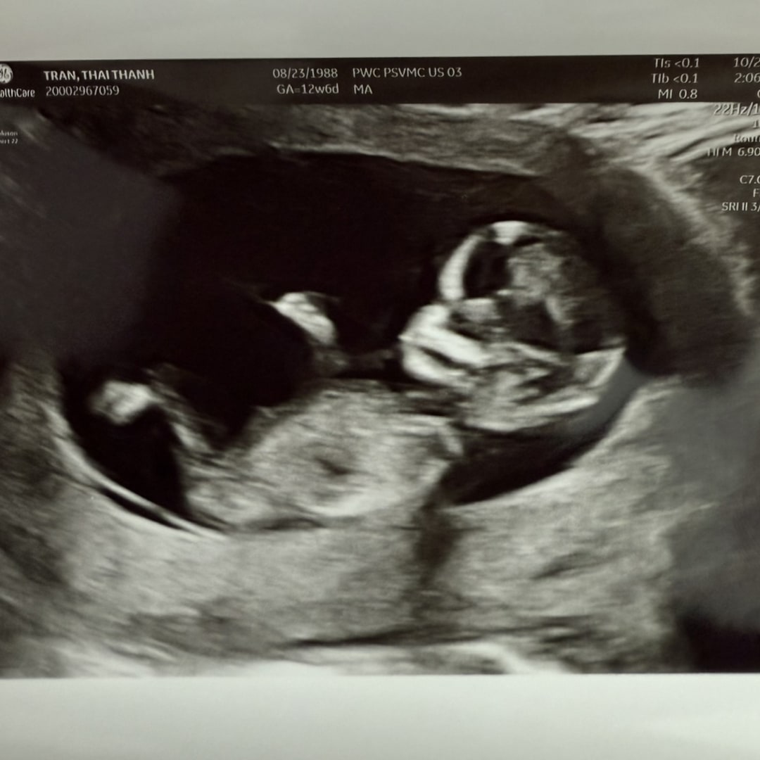 Photo shared by Thai for their Babylist baby registry.